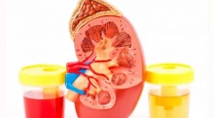 Kri v mačji pladenj: zakaj mačka razjezi kri in kaj storiti glede tega